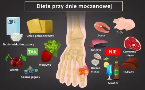 Dieta przy dnie moczanowej: co pić? Zalecane: nabiał, chleb pełnoziarnisty, warzywa, wiśnie, czarne jagody. Unikać: alkohol, czerwone mięso, podroby, łosoś, tuńczyk.